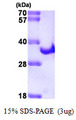 HCV NS3 Protein