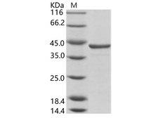 HCV NS3 Protein - Recombinant HCV (HCV-1a) NS3 protease / helicase immunodominant region Protein (aa 1356-1459, GST Tag)
