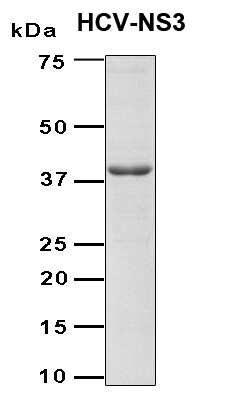 HCV NS3 Protein