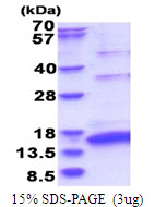 HCV NS5a Protein