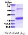 HCV NS5b Protein