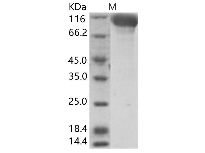 Hantaan Virus Glycoprotein Protein - Recombinant Hendra virus (HeV) (isolate Horse/Autralia/Hendra/1994) Glycoprotein Protein (Fc Tag)