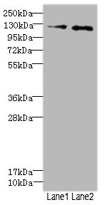 HEPH / Hephaestin Antibody - Western blot All Lanes: HEPH antibody at 2.49ug/ml Lane 1: HepG-2 whole cell lysate Lane 2: Jurkat whole cell lysate Secondary Goat polyclonal to rabbit IgG at 1/10000 dilution Predicted band size: 131,137,101 kDa Observed band size: 130 kDa