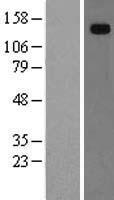 HEPH / Hephaestin Protein - Western validation with an anti-DDK antibody * L: Control HEK293 lysate R: Over-expression lysate