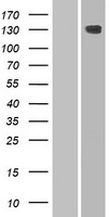 HEPHL1 Protein - Western validation with an anti-DDK antibody * L: Control HEK293 lysate R: Over-expression lysate