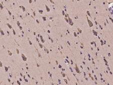 HERC2 Antibody - Immunochemical staining of human HERC2 in human brain with rabbit polyclonal antibody at 1:300 dilution, formalin-fixed paraffin embedded sections.