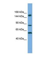HERC3 Antibody - Western blot of Human ACHN. HERC3 antibody dilution 1.0 ug/ml.  This image was taken for the unconjugated form of this product. Other forms have not been tested.