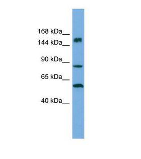 HERC3 Antibody - Western blot of Human ACHN. HERC3 antibody dilution 1.0 ug/ml.  This image was taken for the unconjugated form of this product. Other forms have not been tested.