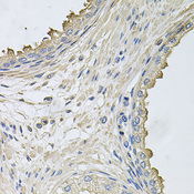 HERC3 Antibody - Immunohistochemistry of paraffin-embedded human prostate.