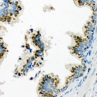 HERC3 Antibody