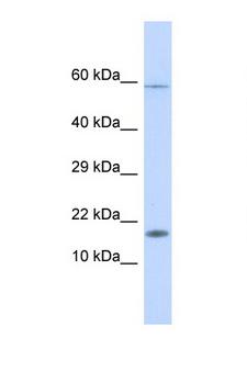 HERC4 Antibody - HERC4 antibody Western blot of Fetal Liver lysate. Antibody concentration 1 ug/ml. This image was taken for the unconjugated form of this product. Other forms have not been tested.