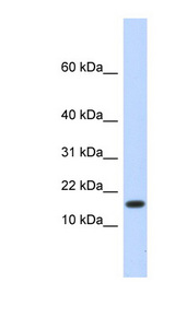 HERC4 Antibody - HERC4 antibody Western blot of Fetal Liver lysate. This image was taken for the unconjugated form of this product. Other forms have not been tested.