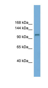 HERC6 Antibody - HERC6 antibody Western blot of ACHN lysate. This image was taken for the unconjugated form of this product. Other forms have not been tested.