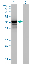 HERPUD1 / HERP Antibody - Western blot of HERPUD1 expression in transfected 293T cell line by HERPUD1 monoclonal antibody (M04), clone 2G7.