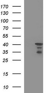 HERPUD1 / HERP Antibody - HEK293T cells were transfected with the pCMV6-ENTRY control (Left lane) or pCMV6-ENTRY HERPUD1 (Right lane) cDNA for 48 hrs and lysed. Equivalent amounts of cell lysates (5 ug per lane) were separated by SDS-PAGE and immunoblotted with anti-HERPUD1.