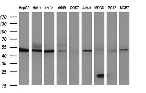 HERPUD1 / HERP Antibody - Western blot of extracts (35ug) from 9 different cell lines by using anti-HERPUD1 monoclonal antibody (HepG2: human; HeLa: human; SVT2: mouse; A549: human; COS7: monkey; Jurkat: human; MDCK: canine; PC12: rat; MCF7: human).