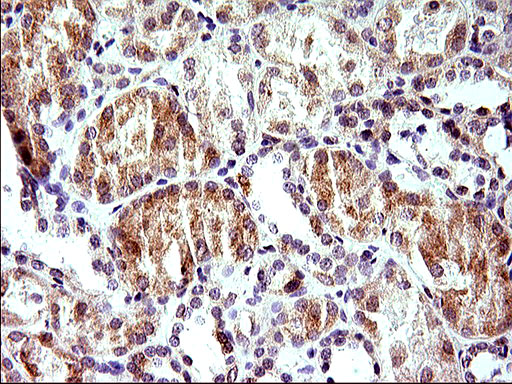 HERPUD1 / HERP Antibody - IHC of paraffin-embedded Human Kidney tissue using anti-HERPUD1 mouse monoclonal antibody. (Heat-induced epitope retrieval by 1 mM EDTA in 10mM Tris, pH8.5, 120°C for 3min).