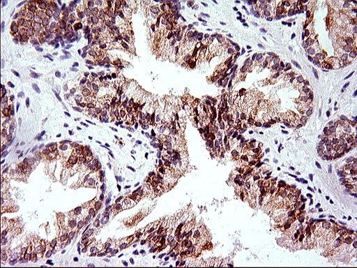 HERPUD1 / HERP Antibody - IHC of paraffin-embedded Human prostate tissue using anti-HERPUD1 mouse monoclonal antibody. (Heat-induced epitope retrieval by 1 mM EDTA in 10mM Tris, pH8.5, 120°C for 3min).