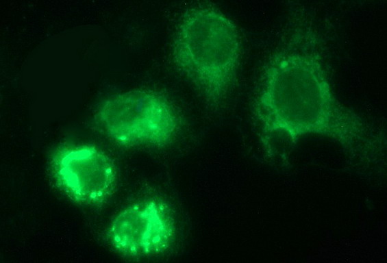 HERPUD1 / HERP Antibody - Anti-HERPUD1 mouse monoclonal antibody immunofluorescent staining of COS7 cells transiently transfected by pCMV6-ENTRY HERPUD1.