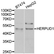 HERPUD1 / HERP Antibody - Western blot analysis of extracts of various cell lines.