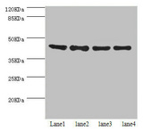 HERPUD1 / HERP Antibody - Western blot All Lanes:HERPUD1 antibody at 2.07ug/ml Lane 1:HepG2 whole cell lysate Lane 2:Hela whole cell lysate Lane 3:PC-3 whole cell lysate Lane 4:293T whole cell lysate Secondary Goat polyclonal to rabbit at 1/10000 dilution Predicted band size: 44,27,41 kDa Observed band size: 44 kDa