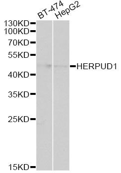 HERPUD1 / HERP Antibody - Western blot analysis of extracts of various cell lines, using HERPUD1 antibody at 1:1000 dilution. The secondary antibody used was an HRP Goat Anti-Rabbit IgG (H+L) at 1:10000 dilution. Lysates were loaded 25ug per lane and 3% nonfat dry milk in TBST was used for blocking. An ECL Kit was used for detection and the exposure time was 90s.
