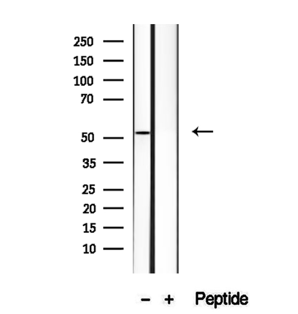 HERPUD1 / HERP Antibody - Western blot analysis of extracts of SW 1990 cells using HERP antibody.