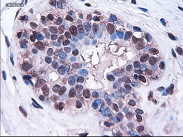 HES1 / HES-1 Antibody - Immunohistochemical staining of paraffin-embedded breast using anti-HES1 mouse monoclonal antibody.