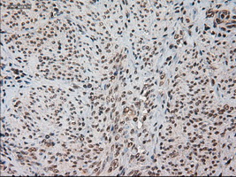 HES1 / HES-1 Antibody - Immunohistochemical staining of paraffin-embedded endometrium using anti-HES1 mouse monoclonal antibody.