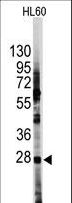 HES1 / HES-1 Antibody - Western blot of anti-HES1 Antibody (N-term T24) (RB13980) in HL60 cell line lysates (35 ug/lane). HES1 (arrow) was detected using the purified antibody.