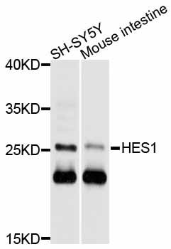 HES1 / HES-1 Antibody - Western blot analysis of extracts of various cell lines, using HES1 antibody at 1:1000 dilution. The secondary antibody used was an HRP Goat Anti-Rabbit IgG (H+L) at 1:10000 dilution. Lysates were loaded 25ug per lane and 3% nonfat dry milk in TBST was used for blocking. An ECL Kit was used for detection and the exposure time was 15s.