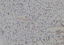 HES1 / HES-1 Antibody - 1:100 staining human gastric tissue by IHC-P. The sample was formaldehyde fixed and a heat mediated antigen retrieval step in citrate buffer was performed. The sample was then blocked and incubated with the antibody for 1.5 hours at 22°C. An HRP conjugated goat anti-rabbit antibody was used as the secondary.