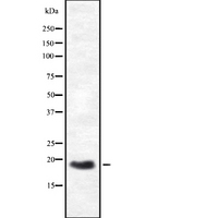 HES3 Antibody - Western blot analysis of HES3 expression in HEK293 cells. The lane on the left is treated with the antigen-specific peptide.