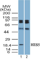 HES5 Antibody - Western blot of HES5 in mouse liver tissue lysate in the 1) absence and 2) presence of immunizing peptide using Polyclonal Antibody to HES5 at 7 ug/ml. Goat anti-rabbit Ig HRP secondary antibody, and PicoTect ECL substrate solution were used for this test.