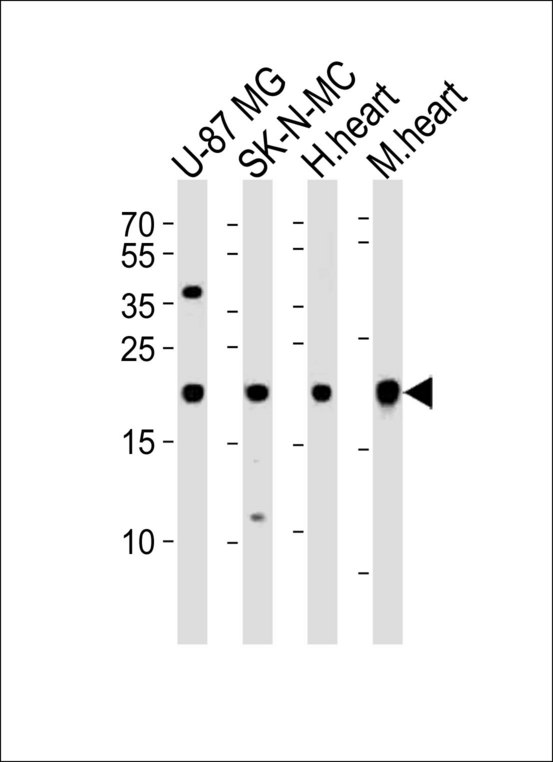 HES5 Antibody - Western blot of lysates from U-87 MG, SK-N-MC cell line, human heart and mouse heart tissue (from left to right) with HES5 Antibody. Antibody was diluted at 1:1000 at each lane. A goat anti-rabbit IgG H&L (HRP) at 1:10000 dilution was used as the secondary antibody. Lysates at 20 ug per lane.