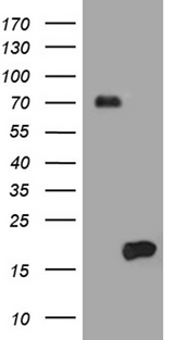 HES5 Antibody - HEK293T cells were transfected with the pCMV6-ENTRY control. (Left lane) or pCMV6-ENTRY HES5. (Right lane) cDNA for 48 hrs and lysed. Equivalent amounts of cell lysates. (5 ug per lane) were separated by SDS-PAGE and immunoblotted with anti-HES5. (1:500)