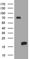 HES5 Antibody - HEK293T cells were transfected with the pCMV6-ENTRY control. (Left lane) or pCMV6-ENTRY HES5. (Right lane) cDNA for 48 hrs and lysed. Equivalent amounts of cell lysates. (5 ug per lane) were separated by SDS-PAGE and immunoblotted with anti-HES5. (1:500)