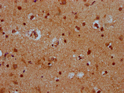 HES5 Antibody - Immunohistochemistry Dilution at 1:400 and staining in paraffin-embedded human brain tissue performed on a Leica BondTM system. After dewaxing and hydration, antigen retrieval was mediated by high pressure in a citrate buffer (pH 6.0). Section was blocked with 10% normal Goat serum 30min at RT. Then primary antibody (1% BSA) was incubated at 4°C overnight. The primary is detected by a biotinylated Secondary antibody and visualized using an HRP conjugated SP system.