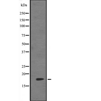 HES5 Antibody - Western blot analysis of HES5 expression in 293 cells lysate. The lane on the left is treated with the antigen-specific peptide.