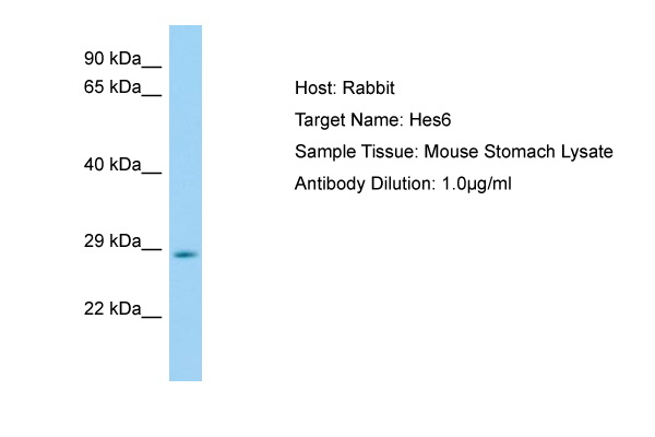 HES6 Antibody -  This image was taken for the unconjugated form of this product. Other forms have not been tested.