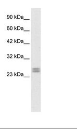 HES7 Antibody - Fetal Heart Lysate.  This image was taken for the unconjugated form of this product. Other forms have not been tested.
