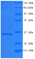 HEV / Hepatitis E Virus ORF1 Protein