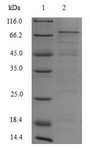 HEV / Hepatitis E Virus ORF2 Protein - (Tris-Glycine gel) Discontinuous SDS-PAGE (reduced) with 5% enrichment gel and 15% separation gel.