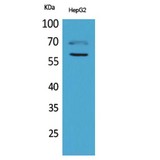 HEXA Antibody - Western blot of HEXA antibody