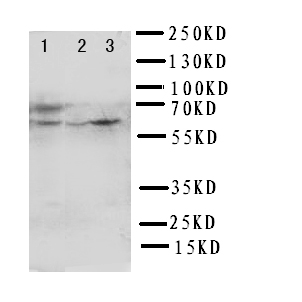 HEXA Antibody - WB of HEXA antibody. Lane 1: Rat Liver Tissue Lysate. Lane 2: HELA Cell Lysate . Lane 3: SMMC Cell Lysate.