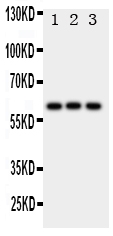 HEXA Antibody - Anti-HEXA antibody, Western blotting All lanes: Anti HEXA at 0.5ug/ml Lane 1: Rat Liver Tissue Lysate at 50ug Lane 2: HELA Whole Cell Lysate at 40ug Lane 3: SMMC Whole Cell Lysate at 40ug Predicted bind size: 61KD Observed bind size: 61KD