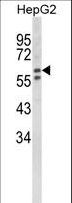 HEXA Antibody - Western blot of HEXA Antibody in HepG2 cell line lysates (35 ug/lane). HEXA (arrow) was detected using the purified antibody.