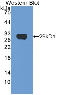 HEXA Antibody - Western blot of recombinant HEXA.