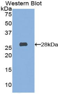 HEXA Antibody - Western blot of recombinant HEXA.  This image was taken for the unconjugated form of this product. Other forms have not been tested.