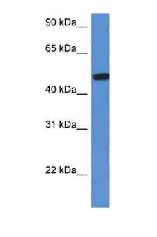 HEXA Antibody - HEXA antibody Western blot of Fetal Kidney lysate. Antibody concentration 1 ug/ml. This image was taken for the unconjugated form of this product. Other forms have not been tested.